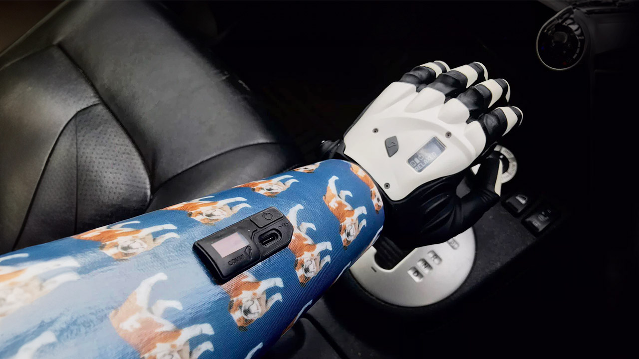 COVVI Provides The First Multi-Articulated Hand Through The NHS COVVI Provides The First Multi-Articulated Hand Through The NHS