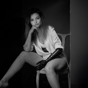 Anna Fusco On Her Journey To Get A COVVI Hand