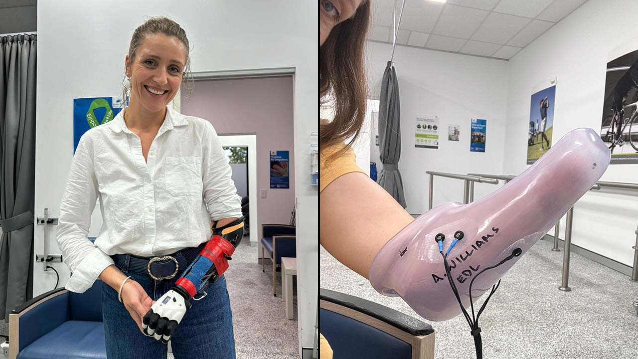 Paralympian, Annabelle Williams, Has Her Final Fitting Of The COVVI Hand Paralympian, Annabelle Williams, Has Her Final Fitting Of The COVVI Hand