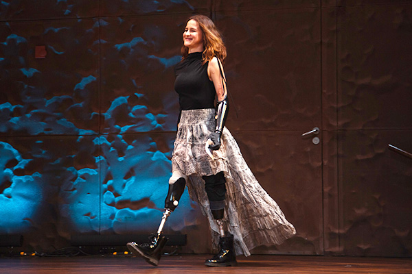 Who Can Use A Bionic Hand?