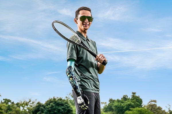 What To Consider As A First Time Upper-Limb Prosthetic User
