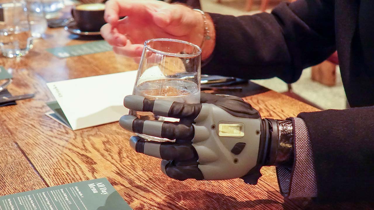 COVVI’s Bionic Hand Now Available For Users in Armenia and Romania